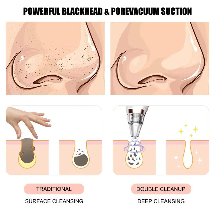Electric blackhead remover device showing before and after pore vacuum suction results on nose. Highlights traditional vs double cleanup cleansing.