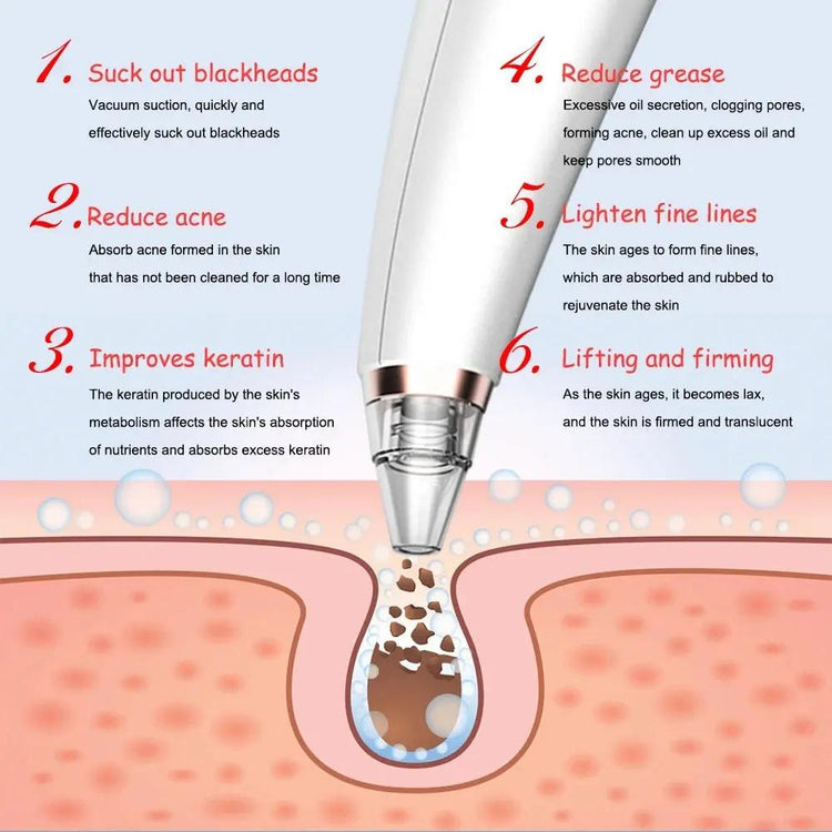Electric blackhead remover device using vacuum suction to clean pores, reduce acne, and improve skin texture. USB rechargeable and rotating design.